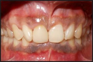 Picture14