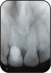 Picture16